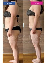 コリオ(KoRiO)/痩身5回目のお客様［狭山ヶ丘］