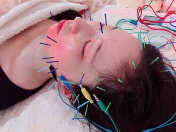 瑞 鍼灸院/頭皮鍼+美容鍼