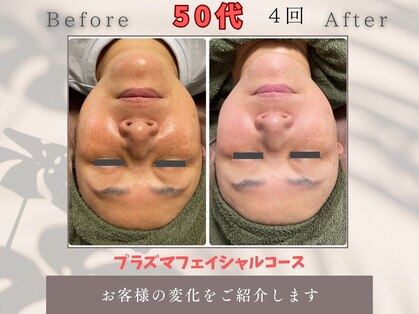 トータルビューティー雅の写真