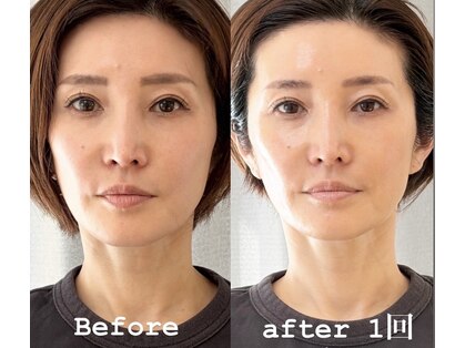 グラースア(grace a)の写真