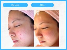 トウメイコガオ 横浜店/トウメイコガオでハーブ