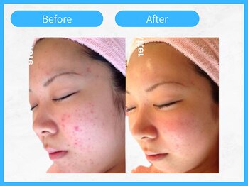 トウメイコガオ 横浜店/トウメイコガオでハーブ