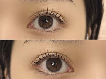 アオ(Ao)の写真/《ダメージレス》一重/奥二重さんも◎悩みに合わせたオーダーメイドデザイン!似合わせラッシュリフト