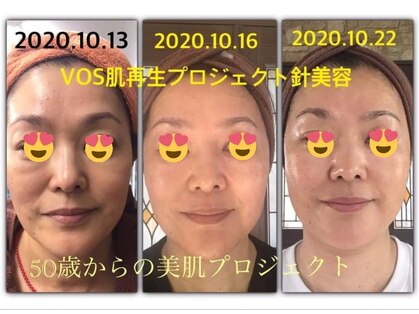エステルーム ソルビエの写真