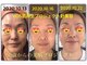 エステルーム ソルビエの写真