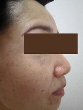 ジョイア 本店(Beauty＆Detox gioia)/安曇野市40代のお客様