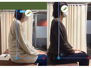 手技整体院 咲蛙/姿勢矯正もお任せください！