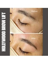 セラス(CERAS)/ハリウッドブロウリフト