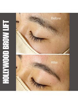 セラス(CERAS)/ハリウッドブロウリフト