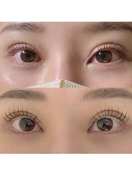 ドルチェ 小田原店(Dolce)/ラッシュアディクト使用前後