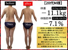 ニコ 岐南本店(Nico)/痩身★Before→after