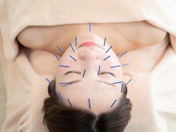 本厚木鍼灸整骨院の写真/《年齢肌サインが出てきたら！痛みが少なく価格を抑えたケアを実現◎》メスを使わないでしわ/たるみ改善♪