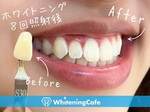 ホワイトニングカフェ 鹿児島中央駅前店の雰囲気(丁寧なカウンセリングでホワイトニングが初めての方でも安心◎)