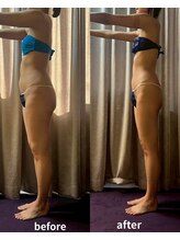 アスエ(ASUE)/エンダモロジー＋サーモシェイプ