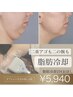 【筑紫野OPEN】諦めていた二重顎・二の腕に!脂肪冷却2回+選べるOP60分¥5940