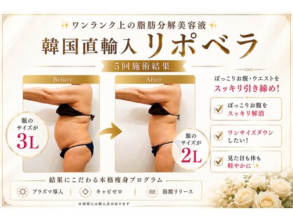 ハピネス(Hapiness)の写真