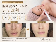 テセラ(Tethere)