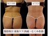 【まずは体験★】仕上がりに差がつく！術後ケア1回体験 ￥5,500