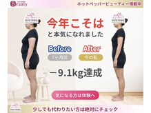 MBF整体院 矢板院の雰囲気（ダイエット目的に運動は８割リバウンドのデータあり）