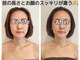 ザヨン(Zayon)の写真/【内側から整える小顔印象×ヘッドスパ】上向きリフトケア好評◎むくみ・首肩の重だるさもスッキリ♪