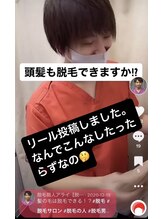 美容脱毛専門サロン エピラージュ 新宿店(Epilage)/全身360°脱毛可能です！