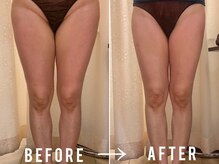 ビュール 銀座(BeauL)/ブライダルエステ／痩身