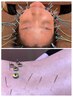 【美容鍼リフトUP！＋鍼灸(うつ伏せのみ)】良いフェイスラインはまず姿勢から