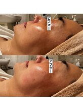 ポーラ 大阪十三店(POLA)/透明感がちがう！一度で手に入る