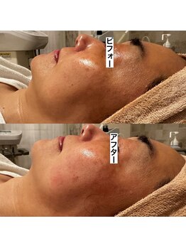 ポーラ 大阪十三店(POLA)/透明感がちがう!一度で手に入る