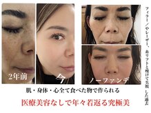 デアマリスの雰囲気（ノーファンデ者続出！コンテスト入賞の実績と信頼！しみケア）