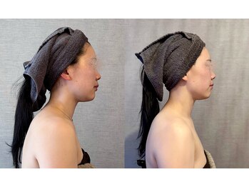 きぃ オリジンプラス(きぃ origin+)の写真/たるみ改善◎リフトアップ小顔フェイシャル