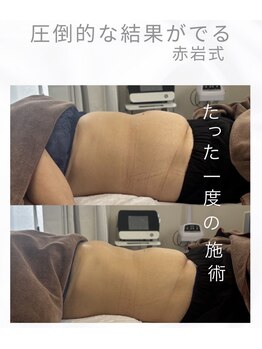 リ クリニカル ラボ(Re clinical Labo)の写真/今話題の腸活♪赤岩式腸削り“最難関技術!ぽっこりお腹/便秘解消/血行促進/腰痛
一度で効果を実感