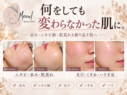 ミャオ(Meow!)の写真