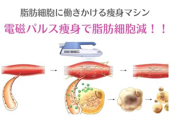 オリエンタルローザ 表参道(Oriental Rosa)/脂肪細胞に働きかける痩身マシン