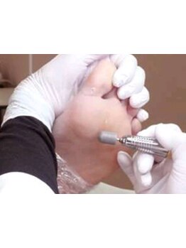 角質ケアができるサロン