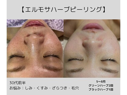ラ コケット(La Coquette)の写真
