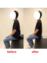ナオル整体 福岡香椎院(NAORU整体)/30代男性施術事例【猫背】