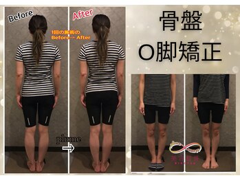 プルーム 久留米店(plume)/身体矯正