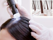 ノーブル(NOBLE)/毛密/育毛促進/大阪/野田阪神