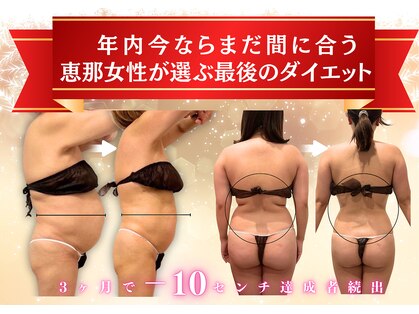 ハナ チュチュ(Hana chuchu)の写真