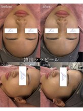 ユフラ(Juhla)/韓国式3D毛穴＋ララピール毛穴