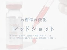ラシック 加古川店(La chic.)/フェイスラインすっきり引き締め