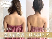 ロココ 名古屋店(Rococo)の雰囲気(お悩み・理想・お身体に合った施術の内容を選抜。名古屋バスト)