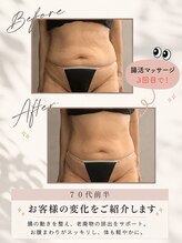 リンガ(Ringa)/1週間便トラブルから毎日快便へ