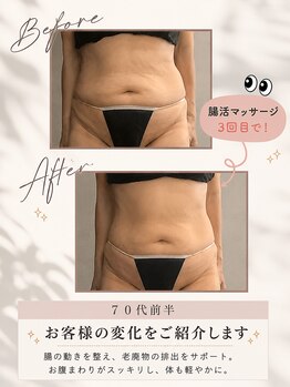 リンガ(Ringa)/1週間便トラブルから毎日快便へ