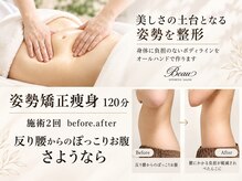 ビュー(Beau)