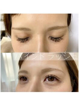 ナル(naru)/バインドラッシュ