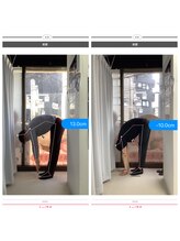 ナオル整体 大森店(NAORU整体)/30代男性、継続施術３ヶ月経過