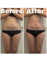 トータルビューティサロン エクスト(EXT)/70分オーダーメイド上半身☆お腹