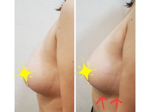 エステティックジュネス(JEUNESSE)/美バストケアコース